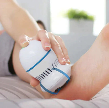 Asymph Vacuum Callus Remover